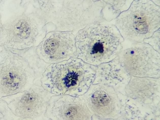 White Fish Mitosis Slides - White Fish Mitosis 08 400X